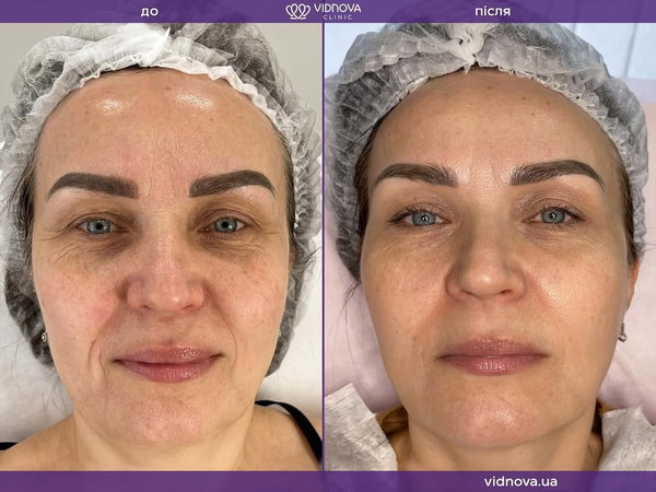 Косметологія Vidnova Clinic