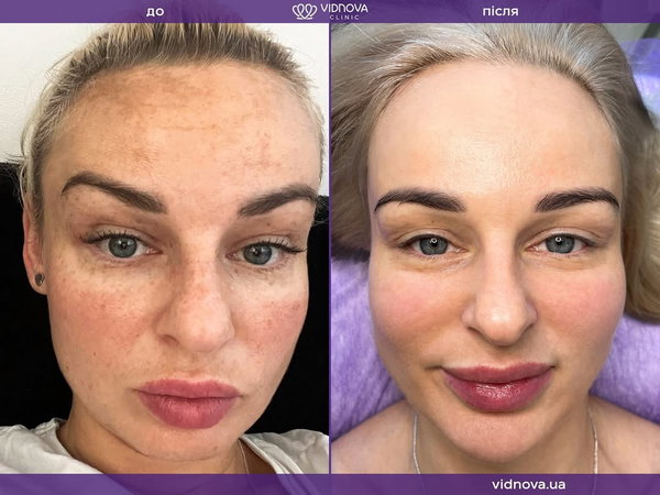 Косметологія Vidnova Clinic